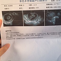 心碎了！输卵管堵塞，做了腹腔镜两个月后有了宝宝！一家人都高兴坏了，第一次6周检查一切都好！但是今天...