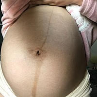 37周不知道是男宝女宝😇😇