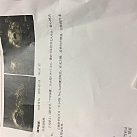 有没有知道的宝妈，帮忙看看正常吗，右侧附件有囊性暗区