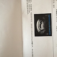 nt检查，b超。懂的看看是男宝宝还是女宝宝，怎么看的啊