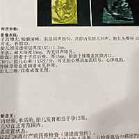 帮忙看看是不是男宝、