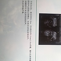 12月1日末次月经，前几天打B超的单子，正常吗，好担心，医生也不给我，直接看了单子就给我了，啥都没说