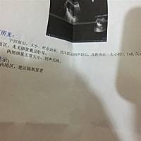 请帮我看看这张B超单。 12月5号 1月6号或者7号来的月经 这两个月因为工作太累 月经不正常 本来都是26号...