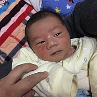 不知道宝宝脸这是怎么了 才出生11天  哪个宝妈可以告知一下 用什么给他涂涂