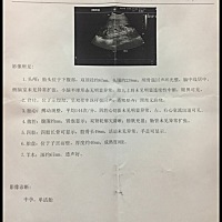 26周和37周的彩超单子 大家帮忙看看是男孩女孩？