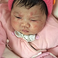 亲们这个是湿疹吗？怎么办？用什么药膏涂抹呢？宝宝不舒服总是哭