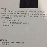 明早的第一台手术，好害怕！八斤六两你吃啥长的呀！😂😂😂😂😂😂还好不用顺产，求一切顺利！