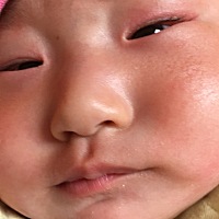 宝宝五个月了，眼睛周围红肿，睫毛根部有眼屎一样的东西，宝宝一直想揉眼睛，周围有时候也会有湿疹一样...