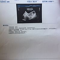 二胎，反正特别大，吃完饭就吐，喝水也吐，还爱犯困，不愿意动。有没有会看男女的，娱乐娱乐