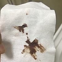 现在有一个月，检查怀孕，然后就一直断断续续排黑褐色分泌物，检查孕酮17.2。不疼不痒的，就一直断断续...