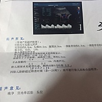 有懂的吗？男孩女孩！