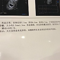 孕8周 孕酮是26.54 hcg是25000 b超显示宝宝只有7周大小 医生说孕酮偏低了 给我开了黄体酮胶囊 有没有哪...