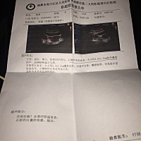 求各位姐妹帮忙！六周，没有出血和腹痛昨天去医院检查医生说宫角孕，请问宝宝可以游回位置吗？