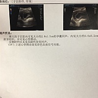 这能看出来男女么，其实都一样，就是想知道，嘻嘻！刚刚七周零2天……