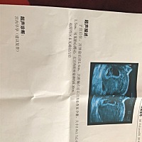 有没有和我同样经历的孕妈？孕囊偏右宫角，9周多，怎么办啊？