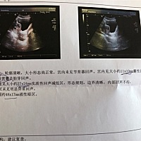 18年1月9日 末次月经来的时间。有没有差不多时间怀孕的宝妈。这几天一直肚子疼，昨天去医院检查，孕酮13...