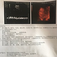 宝妈们帮忙看看男孩女孩