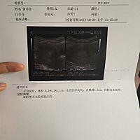 6周。试纸检测出来怀孕。做b超看不到孕囊