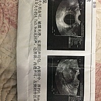 彩超单子上4.7乘3.9是什么意思呀，不是宫外孕吧，验血是怀孕了，但是做彩超看不见结果是这个，我怕是宫...