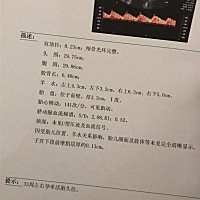 二胎33周，今天B超伤口0.13mm了，上次31周伤口0.21，现在又薄了好多，明天去大医院看看，好怕，今天走出...
