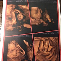 男孩女孩哥哥姐姐们 我好期待我孩子的出生