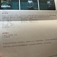 昨天做了检查、宝宝比我的孕期超重了一斤多！我要控制吃饭了！亲们，看看，有一样大的吗？