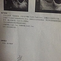 怀孕9周，孕囊位于宫腔中下段，其下缘距子宫前壁下段疤痕处约0.16厘米，这样有对大人有危险吗，请各位大...