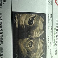 热呼呼的胎心，