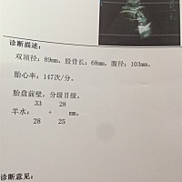 可以看出是男宝还是女宝？