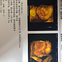 小朋友快出来了🤔