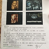 大家帮看看男女！