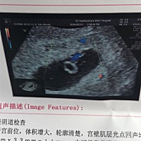 能看出男宝女宝吗？