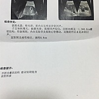 宝妈帮我看看孩子多大啦