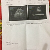 做B超都没什么胎动胎心都好，怎么到22周了还没感觉到胎动？