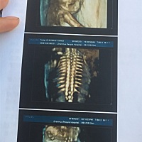 做了5次四维才通过，头胎，亲们有没有懂的可以帮忙看看男孩还是女孩？