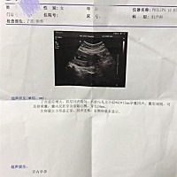 二胎了，能不能帮忙看看男孩女孩