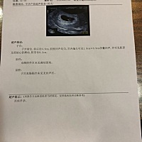 昨天是6周 2天，孕检已经能看到胎芽和胎心了，hcg翻倍的也不错，有点食欲不振还没什么孕吐反应，不过肚...