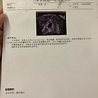 今天来做b超，排除了宫外，心里石头放下了！待血样出来，给医生看结果
