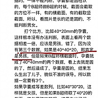 都说40多天的孕囊能看出来 男孩儿女孩儿 有谁知道 是真的吗？