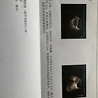 B超小姐姐说不像是两个月的，偏小！   检查了很久才看见胎心。 我一直追而下，后面说看见了，不知道是不...