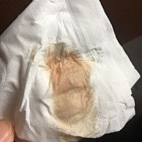 怀孕初期有这样的分泌物是什么情况？求解，谢谢