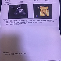 见红了，什么情况？