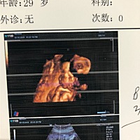 四维通过了，照了四次才照全，还是给个侧脸，对男孩无感啊😒