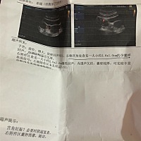 经历过宫角妊娠的姐妹来帮我看一下，下面两张b超图是19号和20号做的，诊断宫角妊娠，快要崩溃了，看了好...