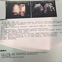 四维……有谁能帮看看，是男宝还是女宝呀？