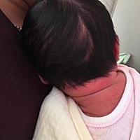 头快出来了但是我没劲了，医生也不让喊，最后医生说孩子心跳不好了，我一用力气生了天哪！无法形容但孩...