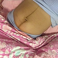 剖腹产今天第八天了，跟孕前的肚子一比心都碎了😭买的收腹带也还没到😅不知道这条黑线啥时候能消