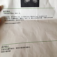 有没有孕早期hcg翻倍不好的？末次月经1.9号 2.10测hcg700多，2.12测hcg1900多，2.22测hcg6000多 医生直...