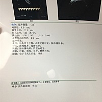 有会看性别和体重的孕妈吗   想知道宝贝现在多少斤了？