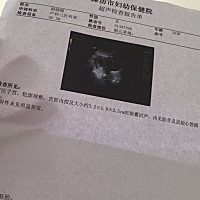 好开心，有胎心了。51天，就是不知道会是男宝女宝